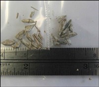 19) Vermiculites used as attic insulations, packaging filler or soil amendments may contain an asbestos contaminent that can be separated from some of the lighter portions of the material, by water flotation. Collection, drying and examination of the fraction that sinks may reveal the presence of the mineral fiber bundles shown.
The individual fibers from these bundles are seen in PG #10.